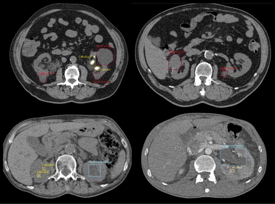 Fig. Detection of abnormalities using AI